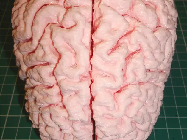 3d printed brain example