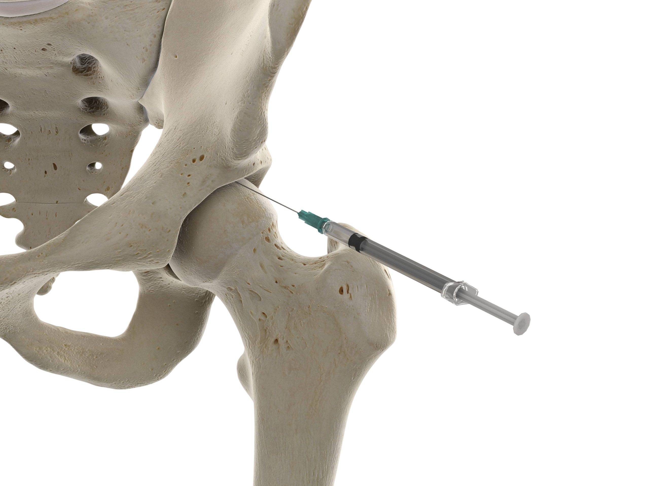 hip injection skeleton