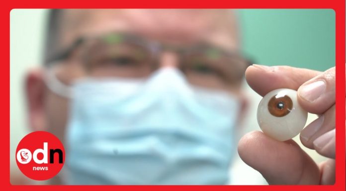 3D Printed Eye: Everything You Need to Know