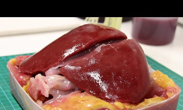 3D Printed Livers: What You Need to Know