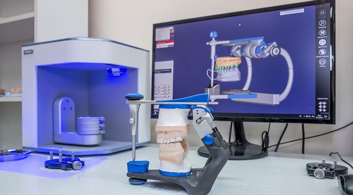 3D Printed Braces: Everything You Need To Know